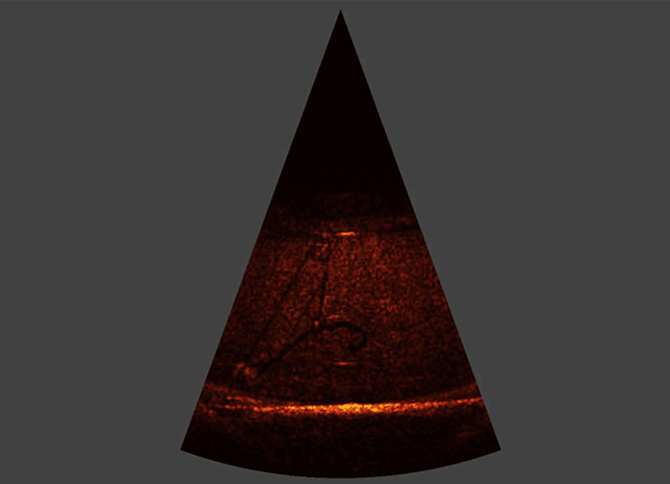 blueprint_oculus_m3000d_imaging_sonar_coat_hanger
